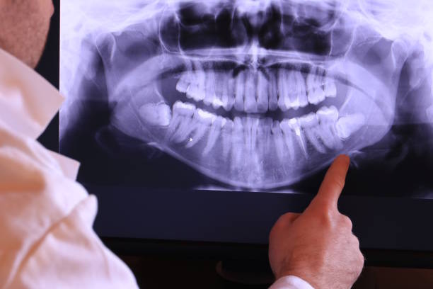 Best Emergency Dental Care for Trauma or Injury in Shelton, WA