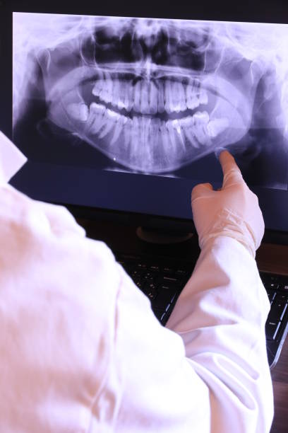 Best Emergency Tooth Extraction in Shelton, WA